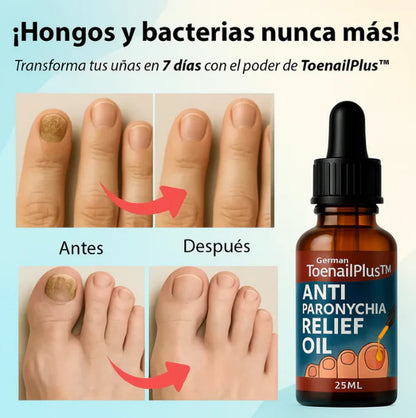 ANTIHONGOS PROMOCIÓN 2 x 1